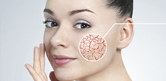 Звезды только на небе: как победить купероз? фото